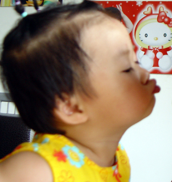 kiss