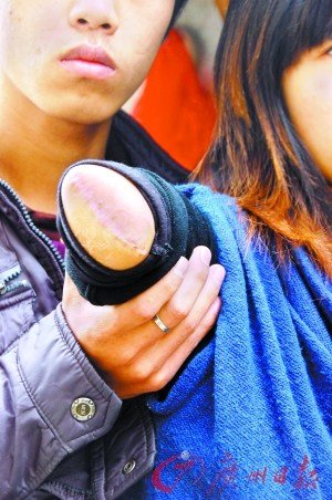 少女深夜被砍断右臂 因无钱被救护车拒送转院